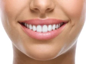 Close-up of a patient's bright white smile showing healthy teeth and pink gums.