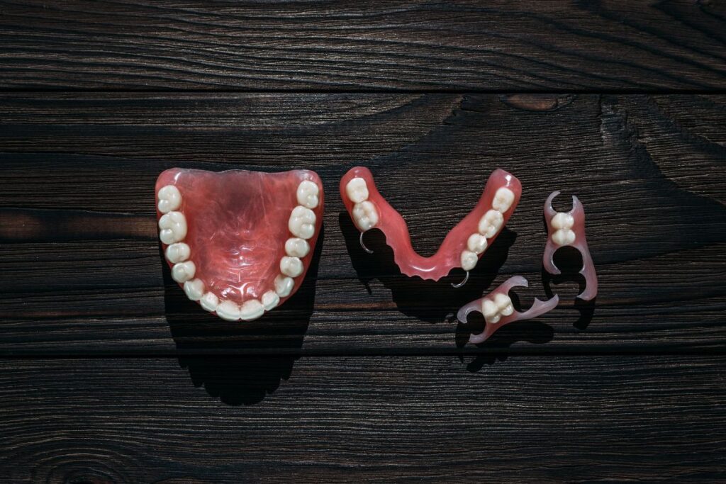 The Advantages of Implant Supported Dentures - Clear Creek Dentistry ...