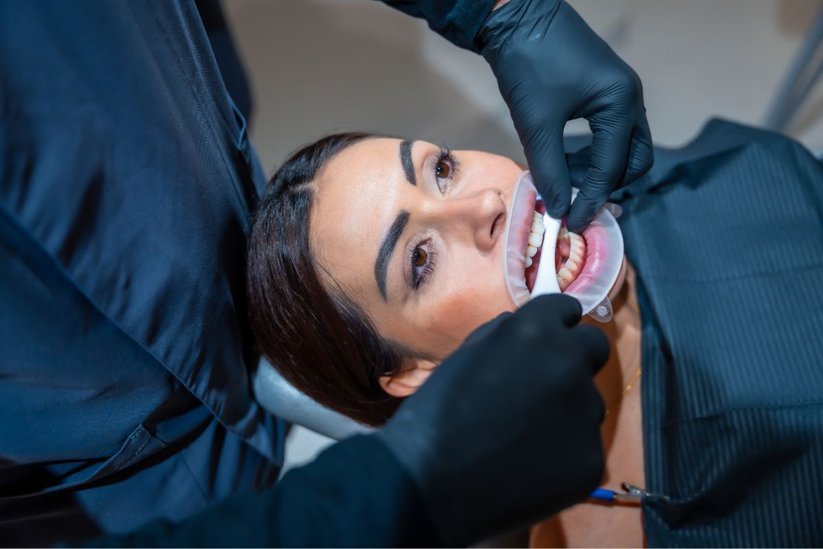 Dentist examining patient's teeth during professional whitening treatment in Silverdale.