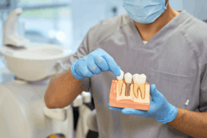 Dental implants for missing teeth in Silverdale, WA