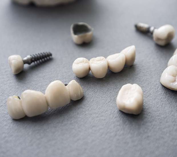Silverdale The Difference Between Dental Implants and Mini Dental Implants
